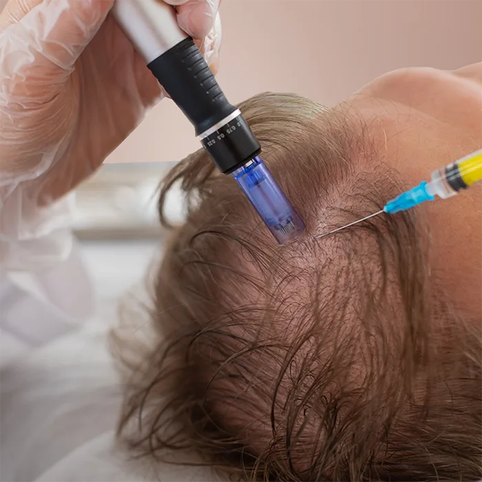 Mesotherapie